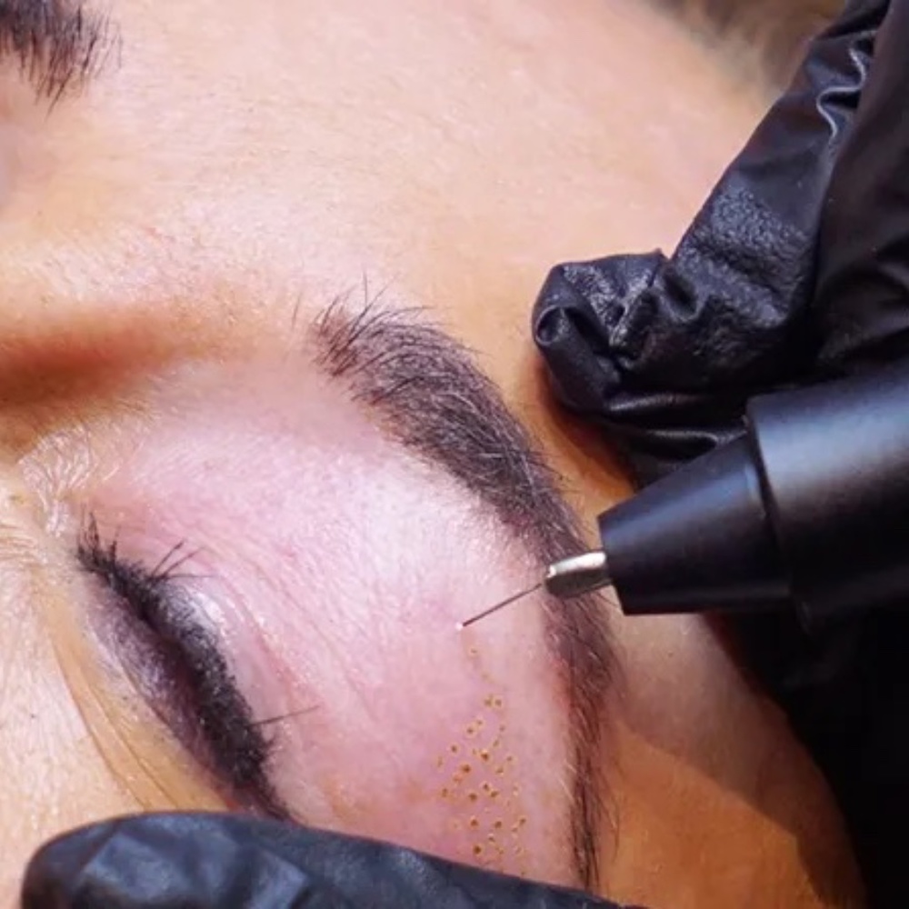 SOLD --- NWT - NEW PlasmaPen Louise Walsh 'Platinum' Fibroblast Device  - Silver - Picture 16 of 16